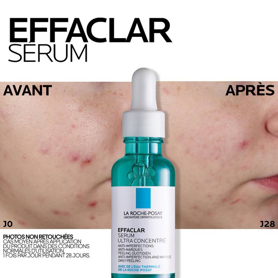 LA ROCHE-POSAY Effaclar Sérum Ultra Concentré 30ml - Peau Pure et Unifiée